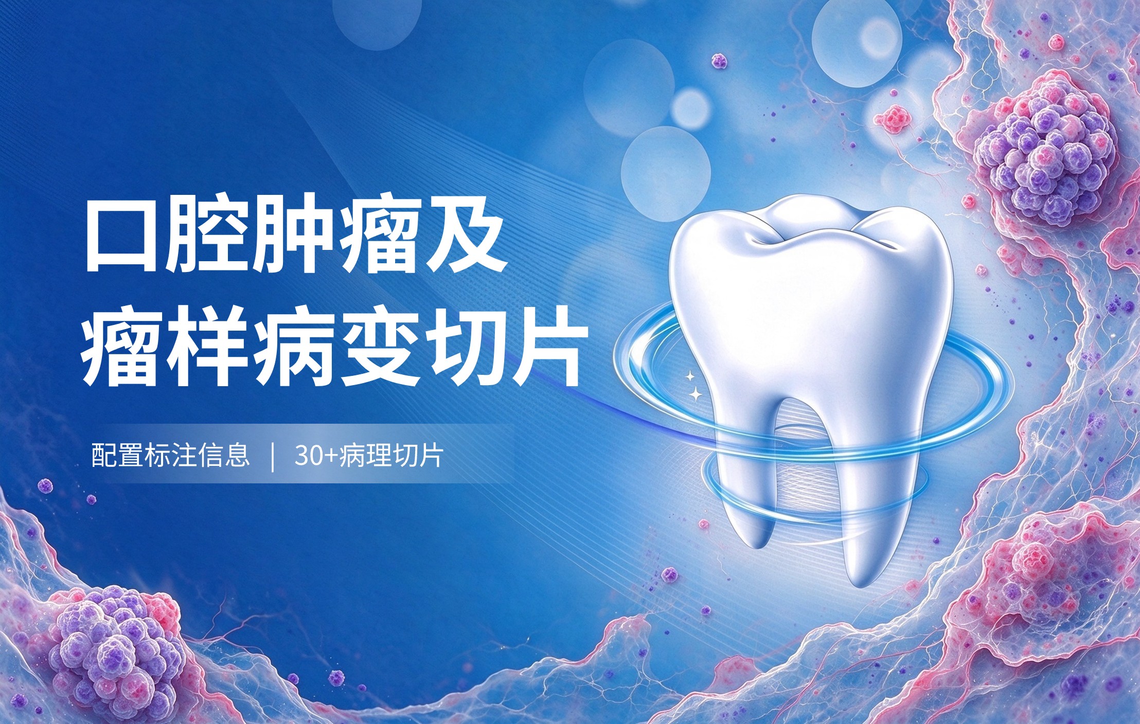 口腔肿瘤切片