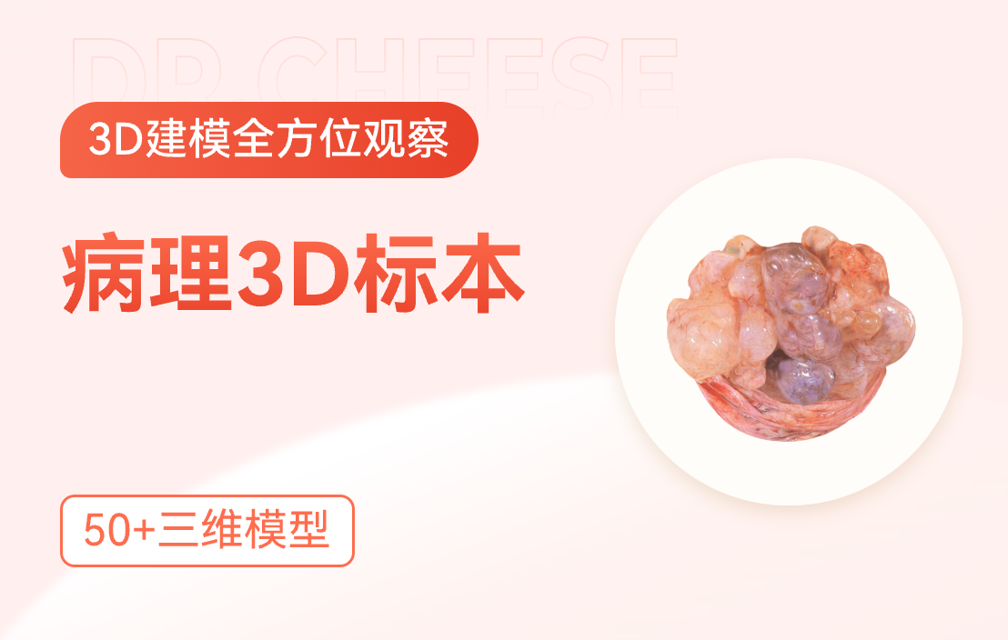 病理3D标本