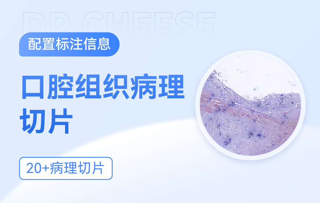 口腔病理切片